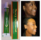 Image result for Where To Buy Mercy Ointment In South Africa
